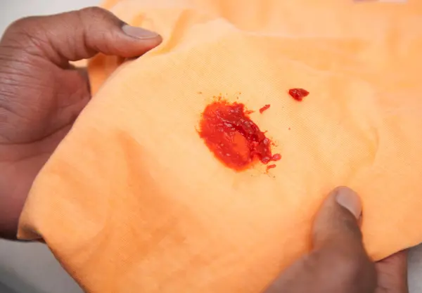 A person holding an orange fabric with a red stain.