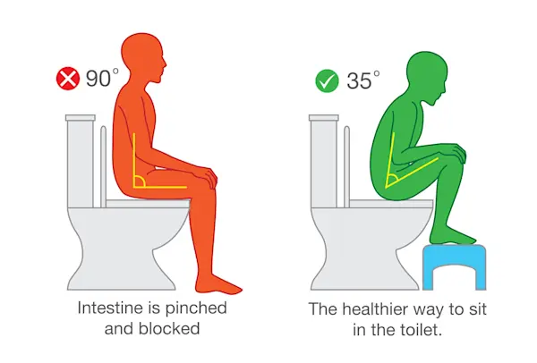 Ilustrasi tentang posisi duduk yang benar dan salah saat menggunakan toilet.