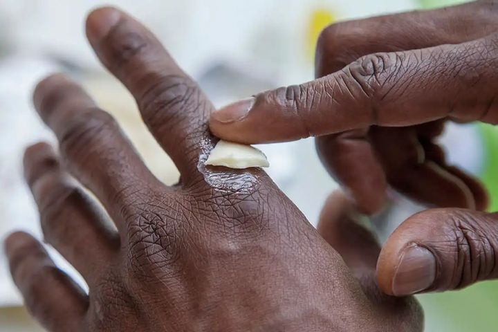 Step 1: A person is rubbing a white substance over their left forefinger knuckle with the forefinger of their right hand